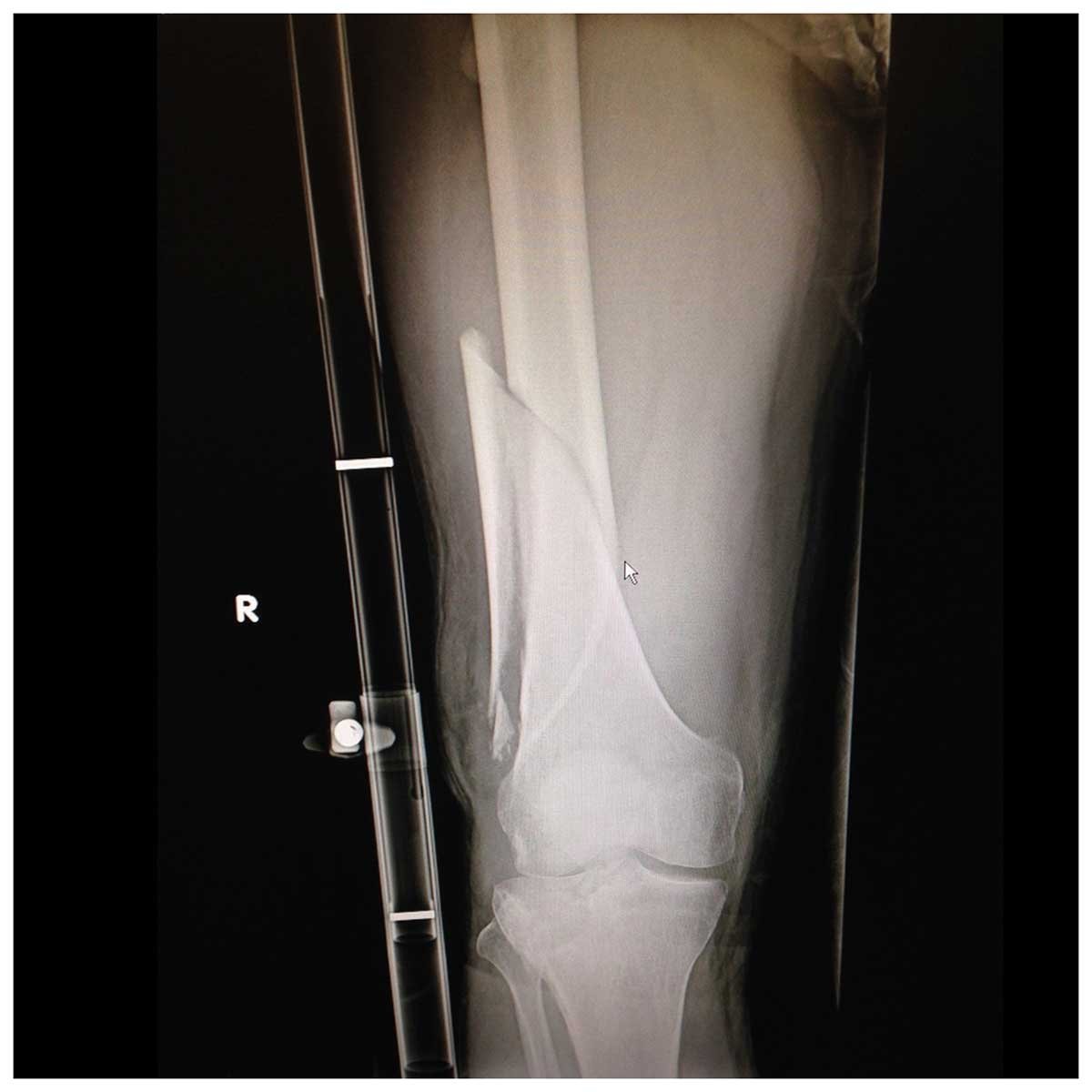 sts_xray_1200_x_1200__14584.1492122359.1280.1280.jpg